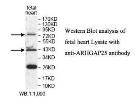 ARHGAP25 Antibody - Western blot of ARHGAP25 antibody