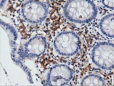 ARHGAP25 Antibody - IHC of paraffin-embedded Human colon tissue using anti-ARHGAP25 mouse monoclonal antibody. (Dilution 1:50).