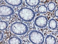 ARHGAP25 Antibody - Immunohistochemical staining of paraffin-embedded Human colon tissue using anti-ARHGAP25 mouse monoclonal antibody. (Dilution 1:50).
