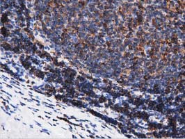 ARHGAP25 Antibody - Immunohistochemical staining of paraffin-embedded Human lymph node tissue using anti-ARHGAP25 mouse monoclonal antibody. (Dilution 1:50).