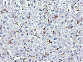 ARHGAP25 Antibody - Immunohistochemical staining of paraffin-embedded Human liver tissue using anti-ARHGAP25 mouse monoclonal antibody. (Dilution 1:50).