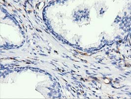 ARHGAP25 Antibody - Immunohistochemical staining of paraffin-embedded Human prostate tissue using anti-ARHGAP25 mouse monoclonal antibody. (Dilution 1:50).