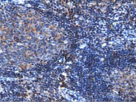 ARHGAP25 Antibody - IHC of paraffin-embedded Human lymph node tissue using anti-ARHGAP25 mouse monoclonal antibody. (Dilution 1:50).