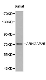 ARHGAP25 Antibody - Western blot of ARHGAP25 pAb in extracts from Jurkat cells.