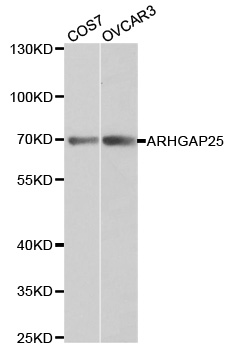ARHGAP25 Antibody - Western blot analysis of extracts of various cell lines, using ARHGAP25 antibody at 1:1000 dilution. The secondary antibody used was an HRP Goat Anti-Rabbit IgG (H+L) at 1:10000 dilution. Lysates were loaded 25ug per lane and 3% nonfat dry milk in TBST was used for blocking.