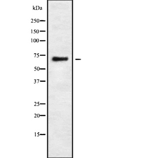 ARHGAP25 Antibody - Western blot analysis of RHG25 using LOVO cells whole cells lysates