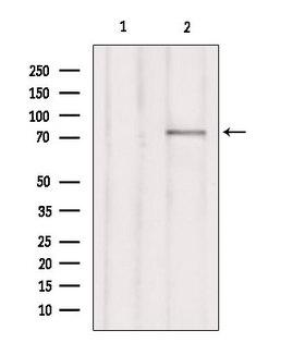 ARHGAP25 Antibody - Western blot analysis of extracts of HepG2 cells using RHG25 antibody. Lane 1 was treated with the blocking peptide.