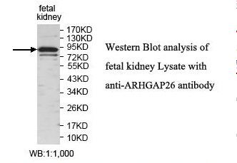 ARHGAP26 / GRAF Antibody