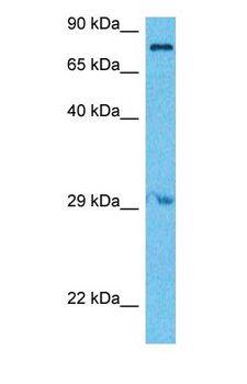 ARHGAP26 / GRAF Antibody - Western blot of RHG26 Antibody with human 721_B Whole Cell lysate.  This image was taken for the unconjugated form of this product. Other forms have not been tested.