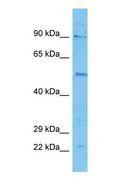 ARHGAP27 Antibody - Western blot of RHG27 Antibody with human HepG2 Whole Cell lysate.  This image was taken for the unconjugated form of this product. Other forms have not been tested.