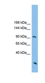 ARHGAP30 Antibody - ARHGAP30 antibody Western blot of HT1080 cell lysate. This image was taken for the unconjugated form of this product. Other forms have not been tested.