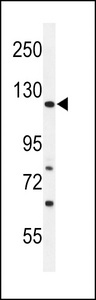 ARHGAP30 Antibody - (LEFT)Western blot of ARHGAP30 Antibody in Ramos cell line lysates (35 ug/lane). ARHGAP30 (arrow) was detected using the purified antibody. (RIGHT)Western blot of ARHGAP30 Antibody in mouse NIH-3T3 cell line lysates (35 ug/lane). ARHGAP30 (arrow) was detected using the purified antibody.