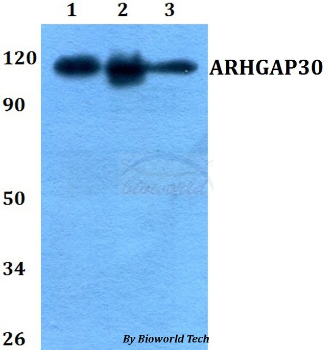 ARHGAP30 Antibody - Western blot of ARHGAP30 antibody at 1:500 dilution. Lane 1: MCF-7 whole cell lysate. Lane 2: Raw264.7 whole cell lysate. Lane 3: PC12 whole cell lysate.