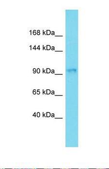 ARHGAP33 / SNX26 Antibody - Western blot of Human 721_B. ARHGAP33 antibody dilution 1.0 ug/ml.  This image was taken for the unconjugated form of this product. Other forms have not been tested.