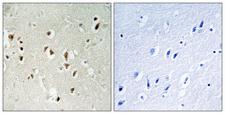 ARHGAP35 / GRLF1 Antibody - Immunohistochemistry analysis of paraffin-embedded human brain tissue, using GRF-1 Antibody. The picture on the right is blocked with the synthesized peptide.