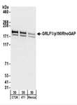 ARHGAP35 / GRLF1 Antibody - Detection of Mouse GRLF1/p190RhoGAP by Western Blot. Samples: Whole cell lysate (50 ug) from CT26.WT, 4T1, and Renca cells. Antibodies: Affinity purified rabbit anti-GRLF1/p190RhoGAP antibody used for WB at 0.04 ug/ml. Detection: Chemiluminescence with an exposure time of 30 seconds.