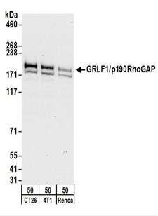 ARHGAP35 / GRLF1 Antibody - Detection of Mouse GRLF1/p190RhoGAP by Western Blot. Samples: Whole cell lysate (50 ug) from CT26.WT, 4T1, and Renca cells. Antibodies: Affinity purified rabbit anti-GRLF1/p190RhoGAP antibody used for WB at 0.04 ug/ml. Detection: Chemiluminescence with an exposure time of 30 seconds.