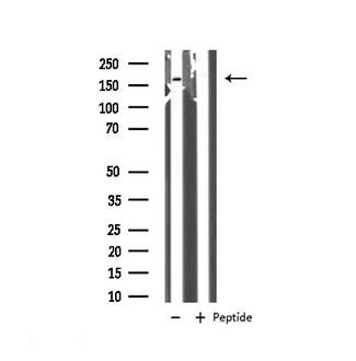ARHGAP35 / GRLF1 Antibody - Western blot analysis of GRF-1 expression in 293 whole cells lysates. The lane on the left is treated with the antigen-specific peptide.