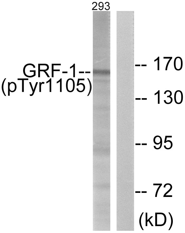ARHGAP35 / GRLF1 Antibody - Western blot analysis of lysates from 293 cells treated with EGF 200ng/ml 30', using GRF-1 (Phospho-Tyr1105) Antibody. The lane on the right is blocked with the phospho peptide.