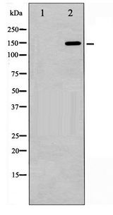 ARHGAP35 / GRLF1 Antibody - Western blot of GRF-1 phosphorylation expression in EGF treated 293 whole cell lysates,The lane on the left is treated with the antigen-specific peptide.