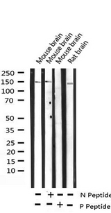 ARHGAP35 / GRLF1 Antibody - Western blot analysis of Phospho-GRF-1 (Tyr1105) expression in various lysates
