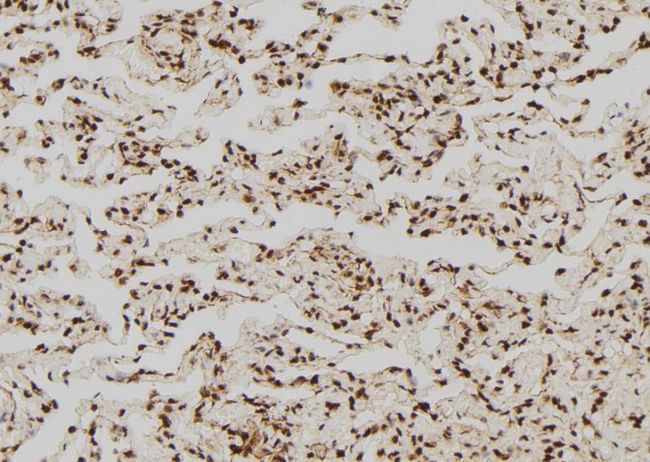 ARHGAP35 / GRLF1 Antibody - 1:100 staining human lung tissue by IHC-P. The sample was formaldehyde fixed and a heat mediated antigen retrieval step in citrate buffer was performed. The sample was then blocked and incubated with the antibody for 1.5 hours at 22°C. An HRP conjugated goat anti-rabbit antibody was used as the secondary.