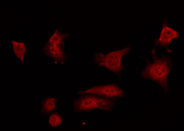 ARHGAP35 / GRLF1 Antibody - Staining 293 cells by IF/ICC. The samples were fixed with PFA and permeabilized in 0.1% Triton X-100, then blocked in 10% serum for 45 min at 25°C. The primary antibody was diluted at 1:200 and incubated with the sample for 1 hour at 37°C. An Alexa Fluor 594 conjugated goat anti-rabbit IgG (H+L) Ab, diluted at 1/600, was used as the secondary antibody.