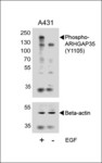 ARHGAP35 / GRLF1 Antibody - Western blot of lysates from A431 cell line, untreated or treated with EGF, 100ng/ml with Phospho-HUMAN-ARHGAP35 (Y1105) (upper) or Beta-actin (lower).
