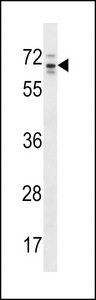 ARHGAP36 / FLJ30058 Antibody - RP13-102H20.1/ARHGAP36 Antibody western blot of HepG2 cell line lysates (35 ug/lane). The RP13-102H20.1 antibody detected the RP13-102H20.1 protein (arrow).