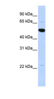 ARHGAP36 / FLJ30058 Antibody - ARHGAP36 / FLJ30058 antibody Western blot of MCF7 cell lysate. This image was taken for the unconjugated form of this product. Other forms have not been tested.