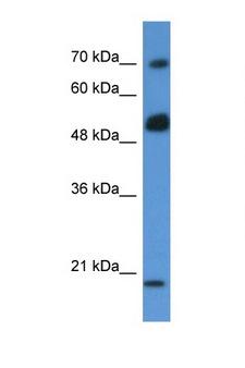 ARHGAP36 / FLJ30058 Antibody - ARHGAP36 / FLJ30058 antibody Western blot of MCF7 Cell lysate. Antibody concentration 1 ug/ml. This image was taken for the unconjugated form of this product. Other forms have not been tested.