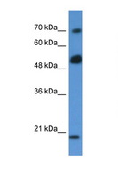 ARHGAP36 / FLJ30058 Antibody - ARHGAP36 / FLJ30058 antibody Western blot of MCF7 Cell lysate. Antibody concentration 1 ug/ml. This image was taken for the unconjugated form of this product. Other forms have not been tested.