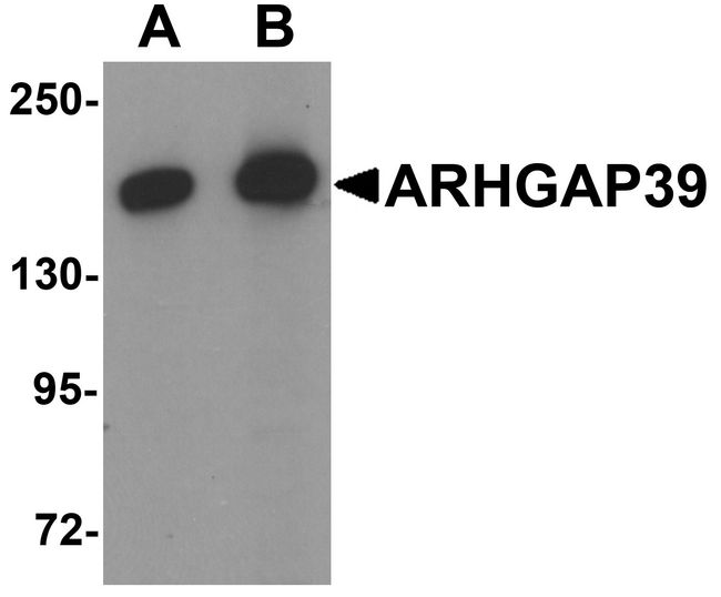 ARHGAP39 Antibody - Western blot analysis of ARHGAP39 in A20 cell lysate with ARHGAP39 antibody at (A) 1 and (B) 2 ug/ml