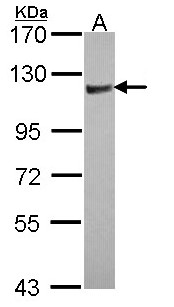 ARHGAP4 Antibody - Sample (30 ug of whole cell lysate). A: JurKat. 7.5% SDS PAGE. ARHGAP4 / p115 antibody diluted at 1:1000.