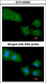 ARHGAP4 Antibody - Immunofluorescence of paraformaldehyde-fixed A549 using Rho GAP4 antibody at 1:200 dilution.