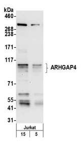 ARHGAP4 Antibody - Detection of human ARHGAP4 by western blot. Samples: Whole cell lysate (5 and 15 µg) from Jurkat cells prepared using NETN lysis buffer. Antibody: Affinity purified rabbit anti-ARHGAP4 antibody used for WB at 0.1 µg/ml. Detection: Chemiluminescence with an exposure time of 30 seconds.