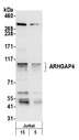 ARHGAP4 Antibody - Detection of human ARHGAP4 by western blot. Samples: Whole cell lysate (5 and 15 µg) from Jurkat cells prepared using NETN lysis buffer. Antibody: Affinity purified rabbit anti-ARHGAP4 antibody used for WB at 0.1 µg/ml. Detection: Chemiluminescence with an exposure time of 30 seconds.
