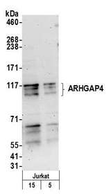 ARHGAP4 Antibody - Detection of human ARHGAP4 by western blot. Samples: Whole cell lysate (5 and 15 µg) from Jurkat cells prepared using NETN lysis buffer. Antibody: Affinity purified rabbit anti-ARHGAP4 antibody used for WB at 0.1 µg/ml. Detection: Chemiluminescence with an exposure time of 3 minutes.