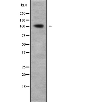 ARHGAP4 Antibody - Western blot analysis of RHG4 using Jurkat whole cells lysates