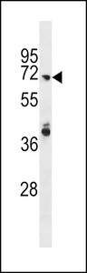 ARHGAP40 Antibody - ARHGAP40 Antibody western blot of HepG2 cell line lysates (35 ug/lane). The ARHGAP40 antibody detected the ARHGAP40 protein (arrow).
