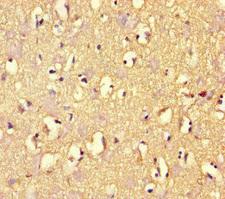 ARHGAP42 Antibody - Immunohistochemistry of paraffin-embedded human brain tissue at dilution of 1:100