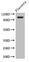 ARHGAP42 Antibody - Western Blot Positive WB detected in:Human placenta tissue All Lanes: ARHGAP42 antibody at 2.8ug/ml Secondary Goat polyclonal to rabbit IgG at 1/50000 dilution Predicted band size: 99 kDa Observed band size: 99 kDa