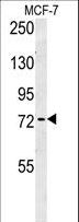 ARHGAP44 Antibody - RICH2 Antibody western blot of MCF-7 cell line lysates (35 ug/lane). The RICH2 antibody detected the RICH2 protein (arrow).