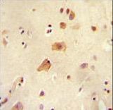 ARHGAP44 Antibody - RICH2 antibody immunohistochemistry of formalin-fixed and paraffin-embedded human brain tissue followed by peroxidase-conjugated secondary antibody and DAB staining.