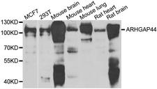 ARHGAP44 Antibody - Western blot analysis of extracts of various cell lines.