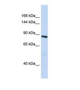 ARHGAP45 Antibody - Western blot of Human Fetal Lung. HMHA1 antibody dilution 1.0 ug/ml.  This image was taken for the unconjugated form of this product. Other forms have not been tested.