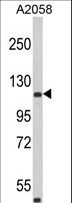 ARHGAP45 Antibody - Western blot of HMHA1 Antibody in A2058 cell line lysates (35 ug/lane). HMHA1 (arrow) was detected using the purified antibody.