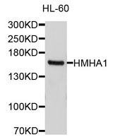 ARHGAP45 Antibody - Western blot analysis of extracts of HL-60 cells, using ARHGAP45 antibody at 1:1000 dilution. The secondary antibody used was an HRP Goat Anti-Rabbit IgG (H+L) at 1:10000 dilution. Lysates were loaded 25ug per lane and 3% nonfat dry milk in TBST was used for blocking. An ECL Kit was used for detection and the exposure time was 15s.