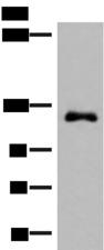 ARHGAP45 Antibody - Western blot analysis of A375 cell lysate  using ARHGAP45 Polyclonal Antibody at dilution of 1:700