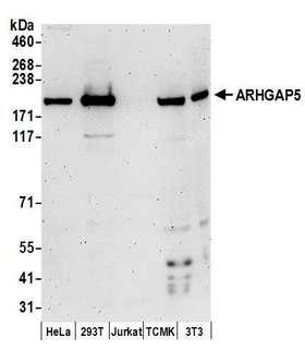 ARHGAP5 / RhoGAP5 Antibody - Detection of human and mouse ARHGAP5 by western blot. Samples: Whole cell lysate (50 µg) from HeLa, HEK293T, Jurkat, mouse TCMK-1, and mouse NIH 3T3 cells prepared using NETN lysis buffer. Antibodies: Affinity purified rabbit anti-ARHGAP5 antibody used for WB at 0.1 µg/ml. Detection: Chemiluminescence with an exposure time of 3 minutes.